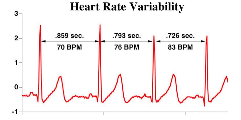 HRV
